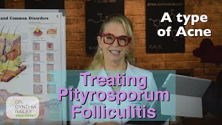 Treat Pityrosporum Folliculitis Dermatologists Tips 2019 [upl. by Tammi500]