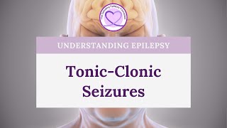 What are TonicClonic Seizures [upl. by Yadsnil]