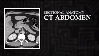 CT Cross Sectional Anatomy Abdomen Axial View [upl. by Leva]