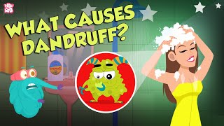 What Causes Dandruff  How To Treat Dandruff  The Dr Binocs Show  Peekaboo Kidz [upl. by Sidhu]