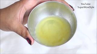 Get Rid of dandruff in 1 Day  Instant Dandruff Remedy at Home [upl. by Friedlander]