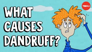 What causes dandruff and how do you get rid of it  Thomas L Dawson [upl. by Aneri270]