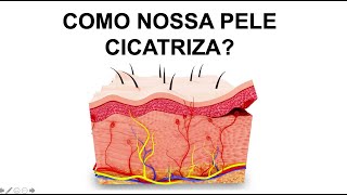 COMO OCORRE A CICATRIZAÇÃO NA PELE Por Luiz Gameiro dermatologista [upl. by Eifos]